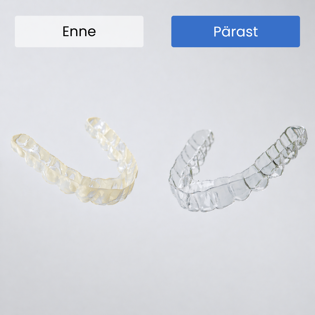 OVIA UV-lainetega ultrahelipuhasti hambakapedele - Pilt 4